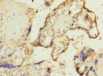 RPIA Antibody