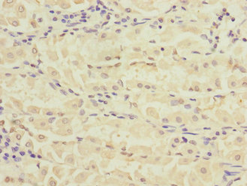 RPIA Antibody
