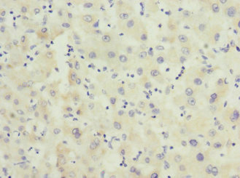 FHL3 Antibody