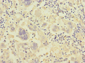 ITGB7 Antibody