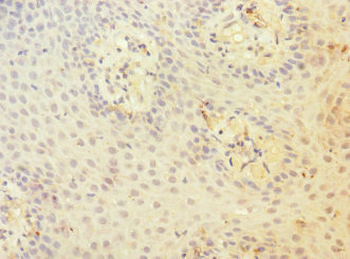 CD97 Antibody