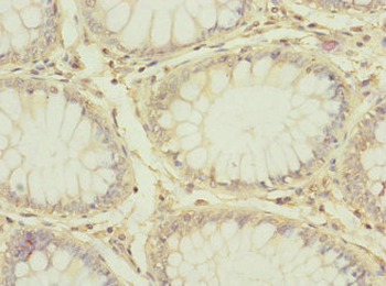 CD97 Antibody