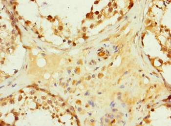 HHIP Antibody