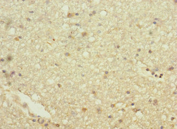 HHIP Antibody