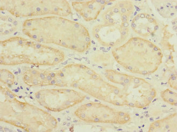SLC22A8 Antibody