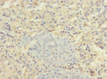SLC22A8 Antibody