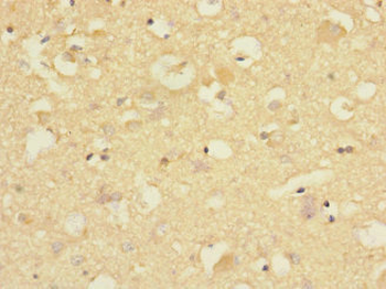 CNTNAP1 Antibody