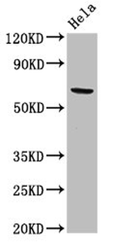 ACADVL Antibody
