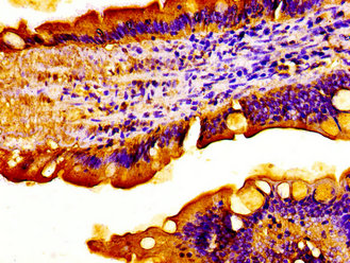 ACADVL Antibody