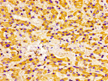 ACADVL Antibody