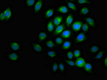 ACADVL Antibody