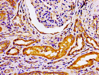 GRK3 Antibody