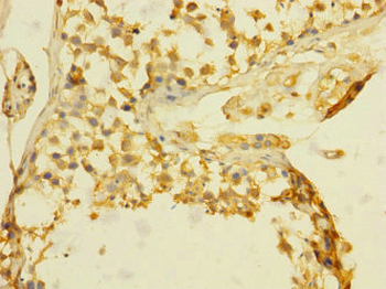 TGFBR3 Antibody