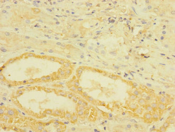 TGFBR3 Antibody