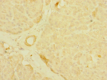 MPP6 Antibody