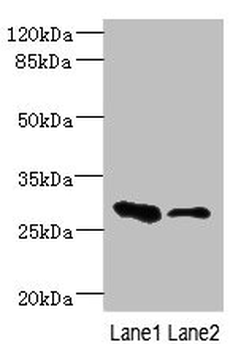 EAF2 Antibody