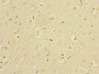 EAF2 Antibody