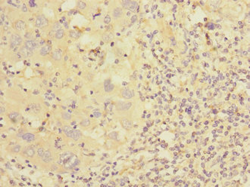 CSRP2 Antibody