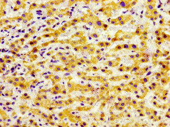 GRK5 Antibody