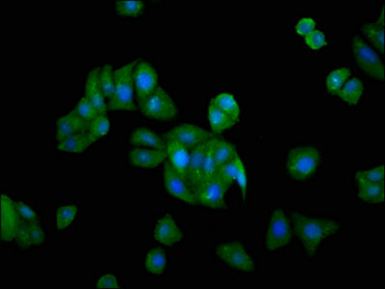 GRK5 Antibody