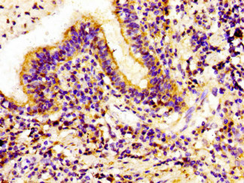 IVL Antibody