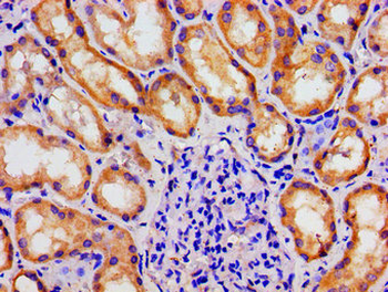 MAST3 Antibody
