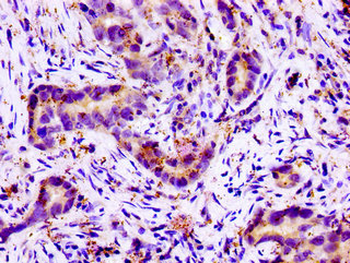 SLC11A2 Antibody