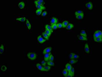 SLC11A2 Antibody