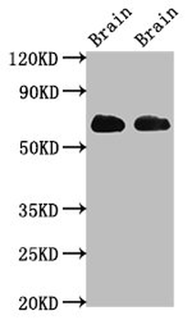 SLC1A2 Antibody