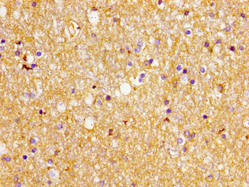 SLC1A2 Antibody
