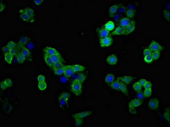 SLC1A2 Antibody