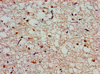 SLC25A12 Antibody