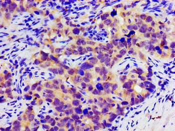 SLC25A12 Antibody