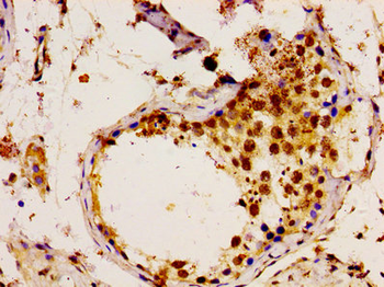 UBE2L3 Antibody