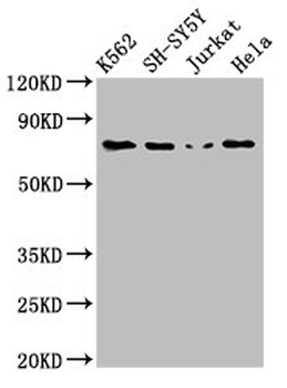 PRKCB Antibody