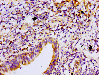 PRKCB Antibody