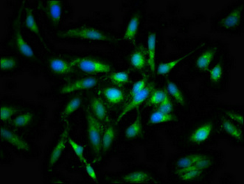 PRKCB Antibody