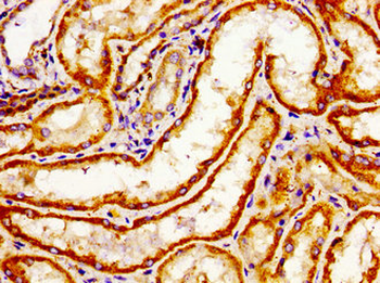 ARHGAP1 Antibody