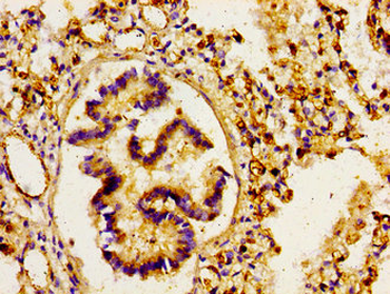 ARHGAP1 Antibody