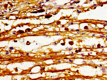 CERS6 Antibody