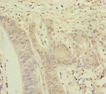 NAA25 Antibody