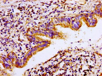 ACO2 Antibody