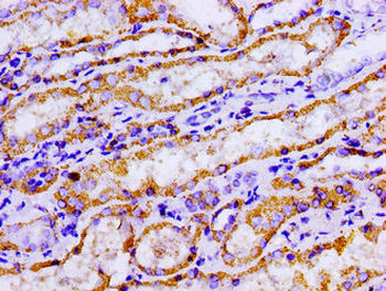ACO2 Antibody