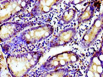TUBGCP4 Antibody
