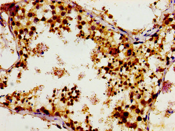 TUBGCP4 Antibody