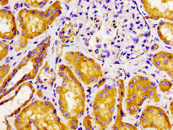 FZD10 Antibody