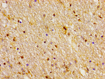 FZD10 Antibody