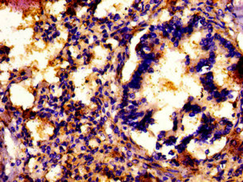 ATP7A Antibody