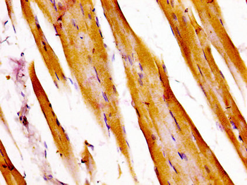 ATXN7 Antibody