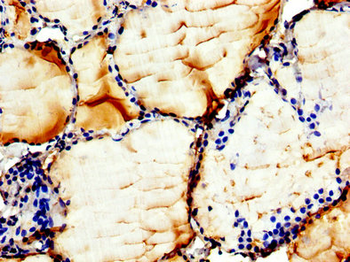 CHKB Antibody
